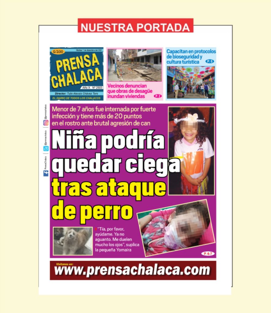 Niña podría quedar ciega tras ataque de perro