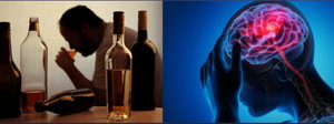 ¡Atención chalacos!: Estudio revela que el alcohol deteriora el cerebro con el tiempo