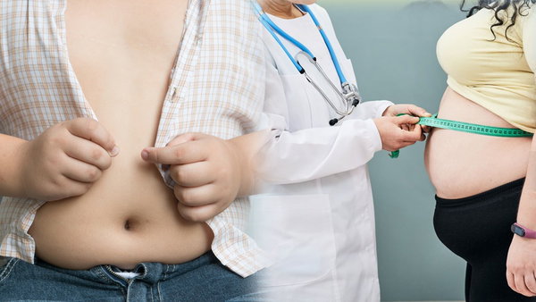 La obesidad ya es la segunda causa de morbilidad entre adolescentes en el Perú
